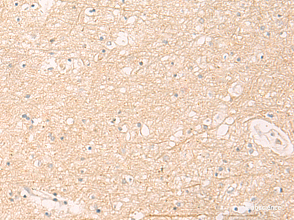 Immunohistochemistry of paraffin-embedded Human brain tissue  using ELP1 Polyclonal Antibody at dilution of 1:30(×200)