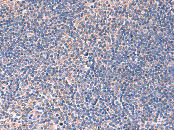 Immunohistochemistry of paraffin-embedded Human tonsil tissue  using INPP5B Polyclonal Antibody at dilution of 1:40(×200)
