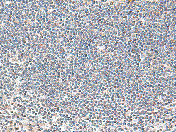 Immunohistochemistry of paraffin-embedded Human tonsil tissue  using IFNA2 Polyclonal Antibody at dilution of 1:40(×200)