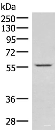 Western blot analysis of Jurkat cell lysate  using IPPK Polyclonal Antibody at dilution of 1:550
