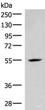 Western blot analysis of Mouse heart tissue lysate  using IRX4 Polyclonal Antibody at dilution of 1:400