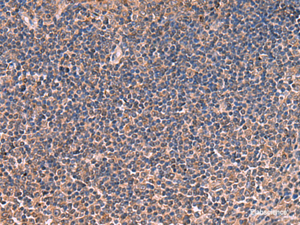 Immunohistochemistry of paraffin-embedded Human tonsil tissue  using ITIH4 Polyclonal Antibody at dilution of 1:30(×200)
