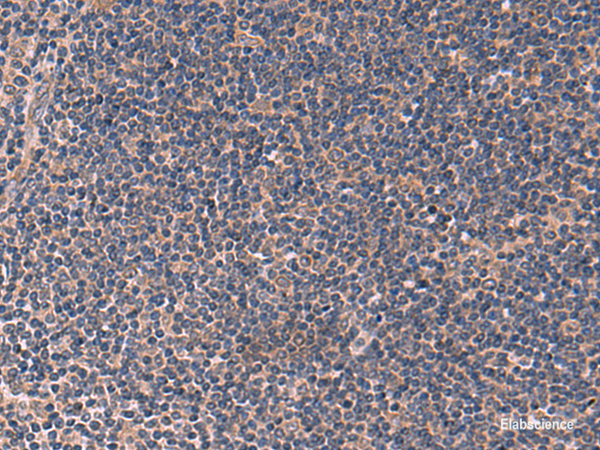 Immunohistochemistry of paraffin-embedded Human tonsil tissue  using ITPR2 Polyclonal Antibody at dilution of 1:60(×200)