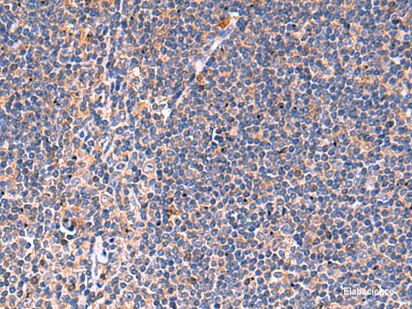 Immunohistochemistry of paraffin-embedded Human tonsil tissue  using KLK9 Polyclonal Antibody at dilution of 1:50(×200)
