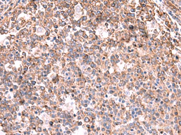 Immunohistochemistry of paraffin-embedded Human tonsil tissue  using KBTBD11 Polyclonal Antibody at dilution of 1:35(×200)