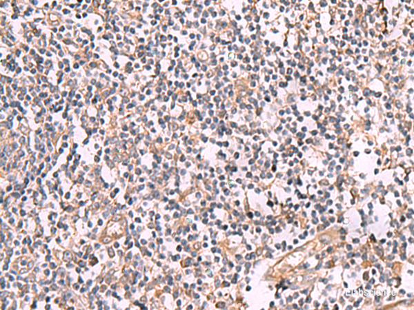 Immunohistochemistry of paraffin-embedded Human tonsil tissue  using SLC12A5 Polyclonal Antibody at dilution of 1:50(×200)