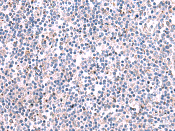 Immunohistochemistry of paraffin-embedded Human tonsil tissue  using KCNK10 Polyclonal Antibody at dilution of 1:35(×200)