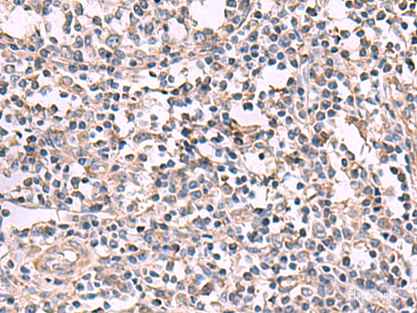 Immunohistochemistry of paraffin-embedded Human tonsil tissue  using KCNK18 Polyclonal Antibody at dilution of 1:80(×200)