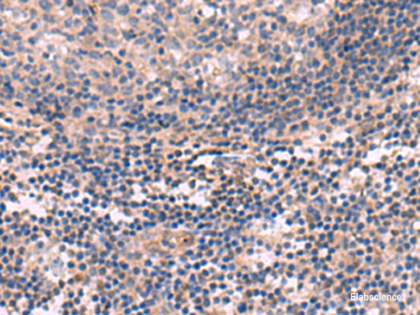 Immunohistochemistry of paraffin-embedded Human tonsil tissue  using KCNT1 Polyclonal Antibody at dilution of 1:30(×200)