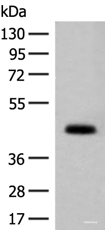 Western blot analysis of Mouse small intestines tissue lysate  using GPA33 Polyclonal Antibody at dilution of 1:200
