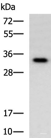 Western blot analysis of Human fetal liver tissue lysate  using IL1B Polyclonal Antibody at dilution of 1:650