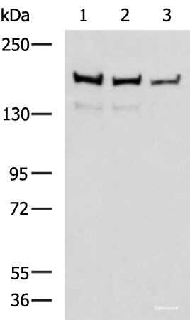 Western blot analysis of Mouse brain tissue Rat brain tissue and HepG2 cell lysates  using ROCK2 Polyclonal Antibody at dilution of 1:400