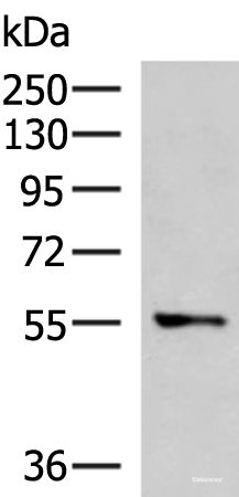 Western blot analysis of A172 cell lysate  using TEKT5 Polyclonal Antibody at dilution of 1:800