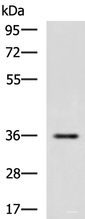 Western blot analysis of Human fetal liver tissue lysate  using IBSP Polyclonal Antibody at dilution of 1:650