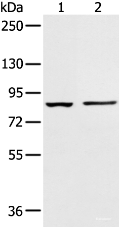 Western blot analysis of 293T cell and Human left kidney tissue  using AAK1 Polyclonal Antibody at dilution of 1:400