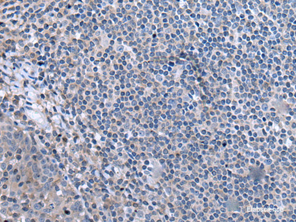 Immunohistochemistry of paraffin-embedded Human tonsil tissue  using CCK Polyclonal Antibody at dilution of 1:55. (Original magnific at ion: ×200) at dilution of 1:55(×200)