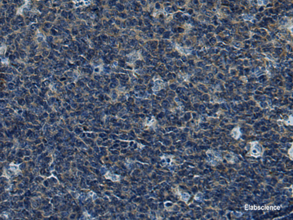 Immunohistochemistry of paraffin-embedded Human tonsil tissue  using CUL5 Polyclonal Antibody at dilution of 1:55(×200)