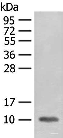 Western blot analysis of Mouse heart tissue lysate  using FABP4 Polyclonal Antibody at dilution of 1:400