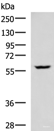 Western blot analysis of LOVO cell lysate  using PDCD4 Polyclonal Antibody at dilution of 1:400
