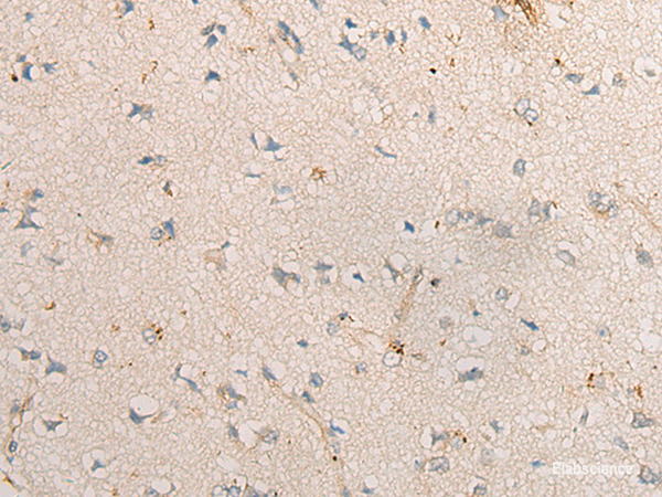 Immunohistochemistry of paraffin-embedded Human brain tissue  using PPM1D Polyclonal Antibody at dilution of 1:60(×200)