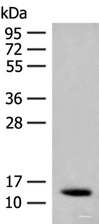 Western blot analysis of Human fetal brain tissue lysate  using AKAP7 Polyclonal Antibody at dilution of 1:200
