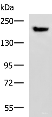 Western blot analysis of Mouse brain tissue lysate  using PDS5B Polyclonal Antibody at dilution of 1:800