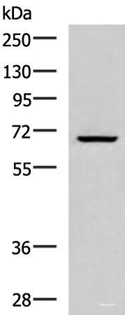 Western blot analysis of Raji cell lysate  using CACNB1 Polyclonal Antibody at dilution of 1:800