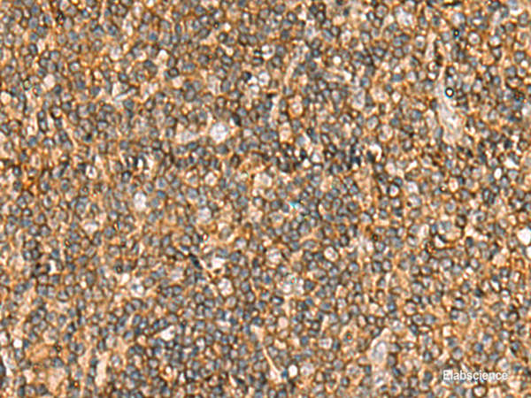 Immunohistochemistry of paraffin-embedded Human tonsil tissue  using NLRC4 Polyclonal Antibody at dilution of 1:50(×200)