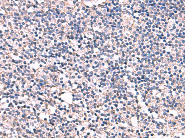 Immunohistochemistry of paraffin-embedded Human tonsil tissue  using ESM1 Polyclonal Antibody at dilution of 1:55(×200)