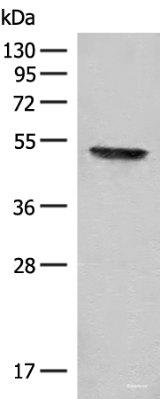 Western blot analysis of Mouse thymus tissue lysate  using FGL2 Polyclonal Antibody at dilution of 1:300