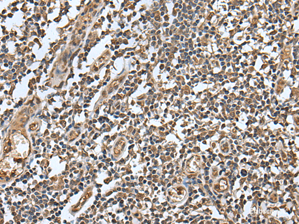 Immunohistochemistry of paraffin-embedded Human tonsil tissue  using LAMTOR5 Polyclonal Antibody at dilution of 1:55(×200)
