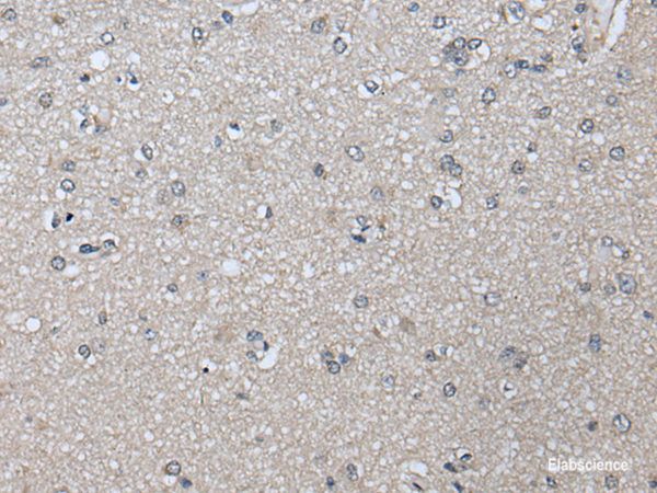 Immunohistochemistry of paraffin-embedded Human brain tissue  using PRAME Polyclonal Antibody at dilution of 1:65(×200)