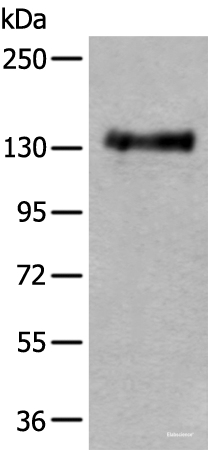 Western blot analysis of Mouse brain tissue lysate  using PTPRA Polyclonal Antibody at dilution of 1:400
