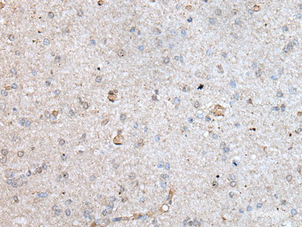 Immunohistochemistry of paraffin-embedded Human brain tissue  using RAB4A Polyclonal Antibody at dilution of 1:40(×200)
