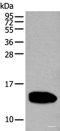 Western blot analysis of Human pancreas tissue lysate  using REG1A Polyclonal Antibody at dilution of 1:350