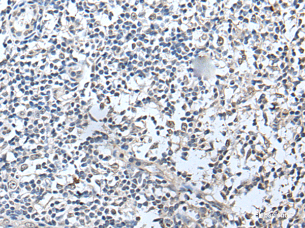 Immunohistochemistry of paraffin-embedded Human tonsil tissue  using RERG Polyclonal Antibody at dilution of 1:50(×200)