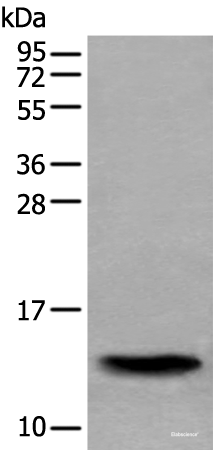 Western blot analysis of Human normal stomach tissue lysate  using SAA4 Polyclonal Antibody at dilution of 1:350