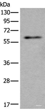 Western blot analysis of Mouse testis tissue lysate  using SCP2 Polyclonal Antibody at dilution of 1:350