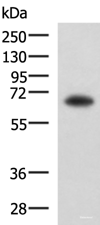Western blot analysis of PC3 cell lysate  using SHC3 Polyclonal Antibody at dilution of 1:650