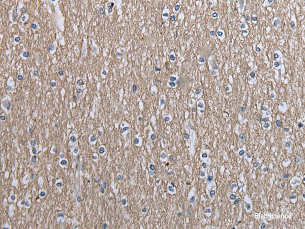 Immunohistochemistry of paraffin-embedded Human brain tissue  using SLC39A14 Polyclonal Antibody at dilution of 1:40(×200)
