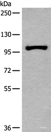 Western blot analysis of HEPG2 cell lysate  using HELLS Polyclonal Antibody at dilution of 1:800