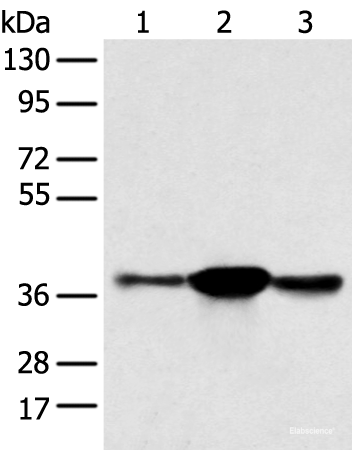 Western blot analysis of K562 A375 and 231 cell  using SPRY4 Polyclonal Antibody at dilution of 1:400