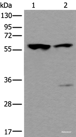 Western blot analysis of Mouse testis tissue and Human testis tissue lysates  using TRIM27 Polyclonal Antibody at dilution of 1:400