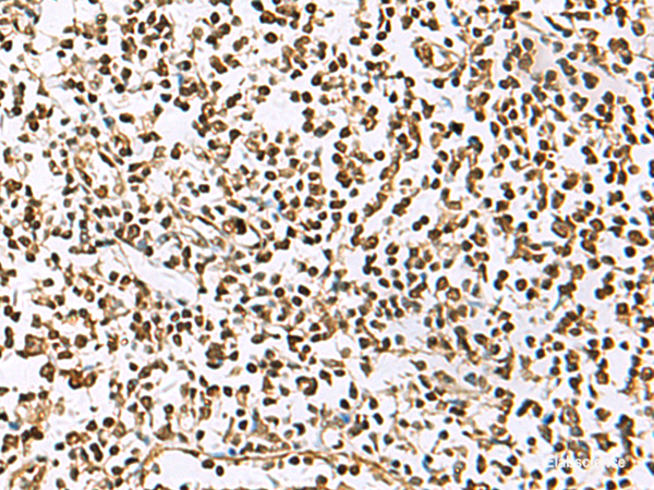 Immunohistochemistry of paraffin-embedded Human tonsil tissue  using UBLCP1 Polyclonal Antibody at dilution of 1:85(×200)