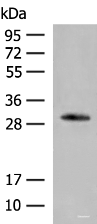 Western blot analysis of Human left thymus tissue lysate  using VDAC3 Polyclonal Antibody at dilution of 1:200
