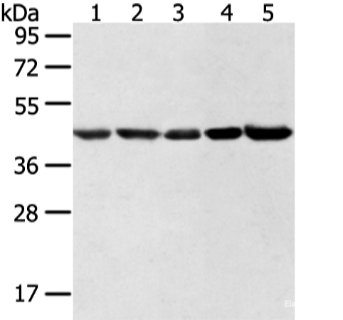 Western blot analysis of Hela lncap NIH/3T3 K562 and 231 cell  using WDR77 Polyclonal Antibody at dilution of 1:500