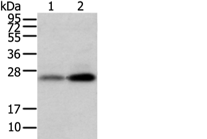Western blot analysis of Mouse trachea and brain tissue  using WFDC5 Polyclonal Antibody at dilution of 1:1100