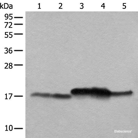 Western blot analysis of Mouse brain tissue Mouse liver tissue 231 cell K562 cell A431 cell lysates  using NDUFB11 Polyclonal Antibody at dilution of 1:1000