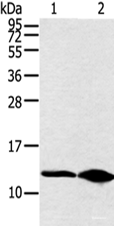 Western blot analysis of Hela cell and human fetal brain tissue  using DYNLL2 Polyclonal Antibody at dilution of 1:250
