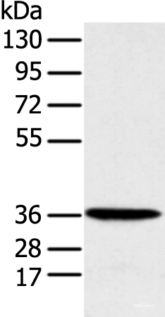 Western blot analysis of Human fetal liver tissue  using MAT2B Polyclonal Antibody at dilution of 1:1000